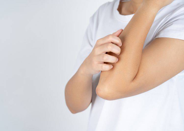 Top Supplements for Itchy Skin